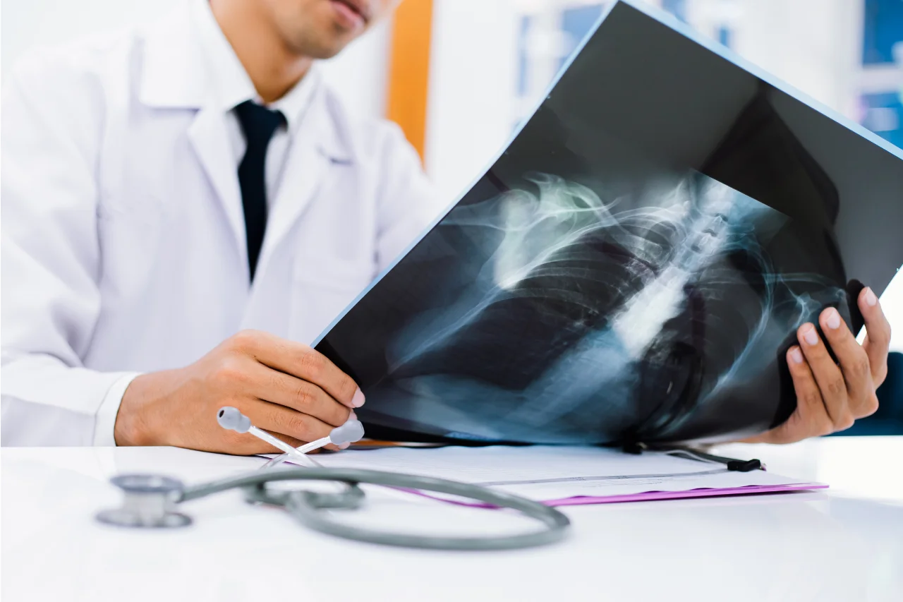 Radiology team reviewing medical imaging